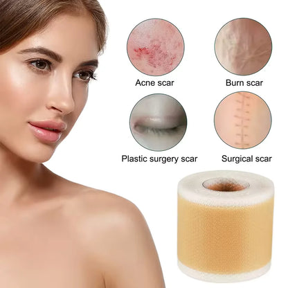 Breathable Adhesive Scar Removing Silicone Tape